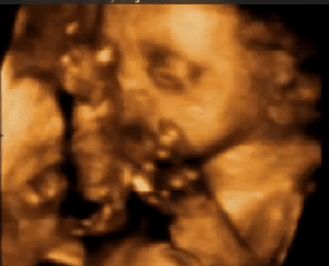 Ecografía de un feto 4D
