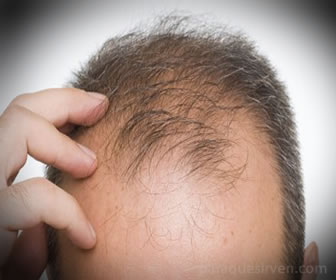 La biotina ayuda a controlar la caída del cabello.