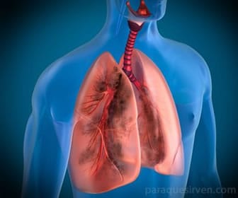 Bactiver sirve para tratar infecciones en las vías respiratorias.